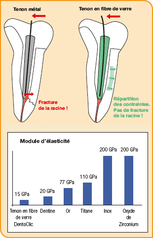 tenon en fibre de verre